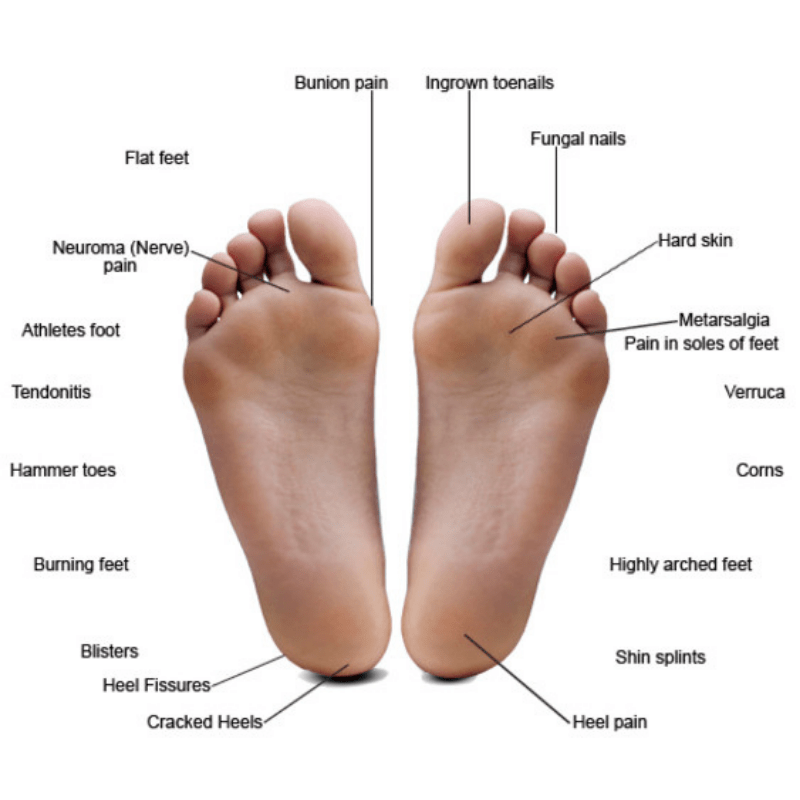 Introduction To Your Feet Foot Pain Treating Foot Pain My Foot Guy